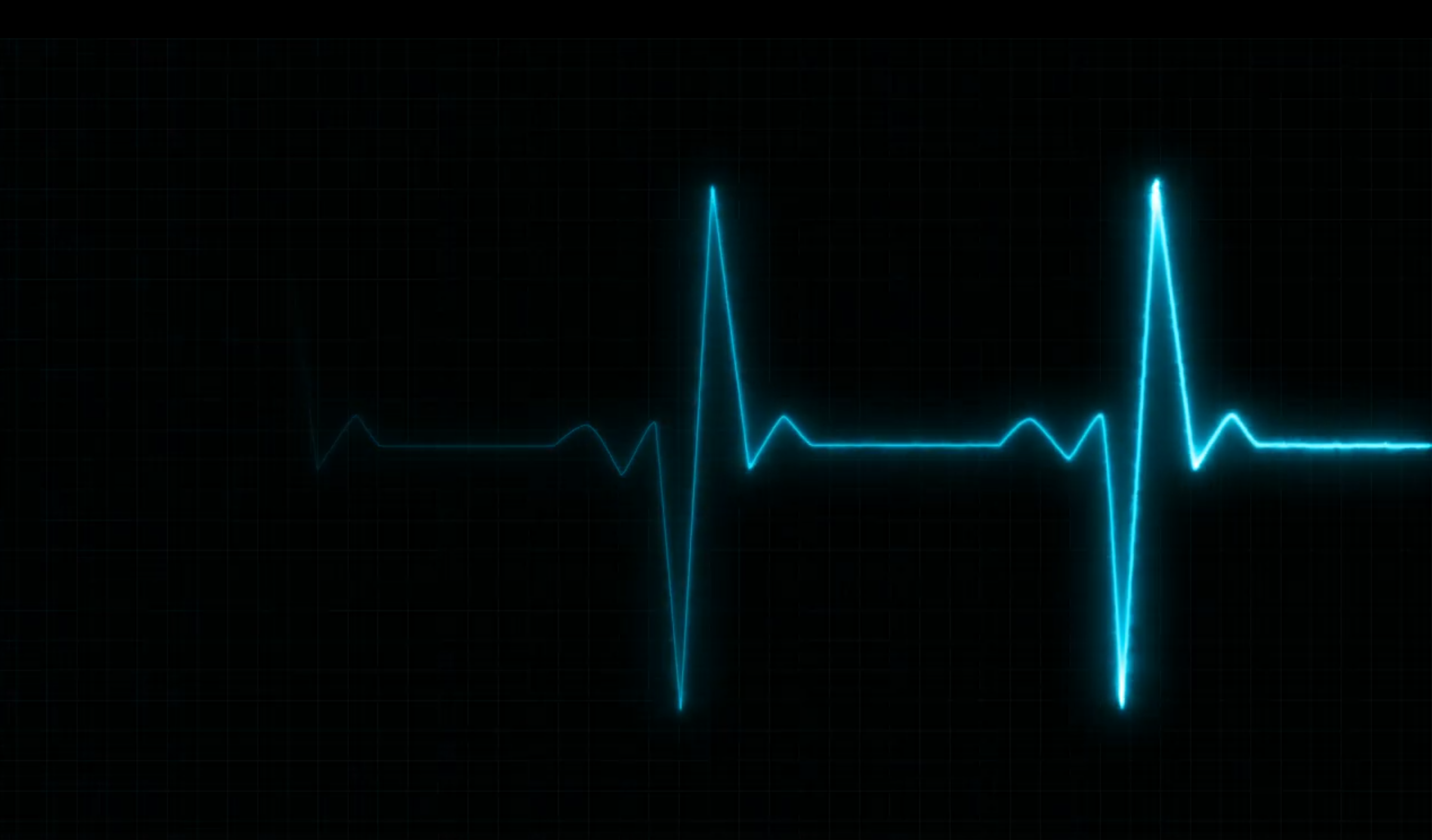 Electrocardiogram against a black background