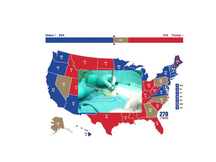 Map of USA with red and blue electoral colors and closeup of surgeon stitching up patient on top of the map.